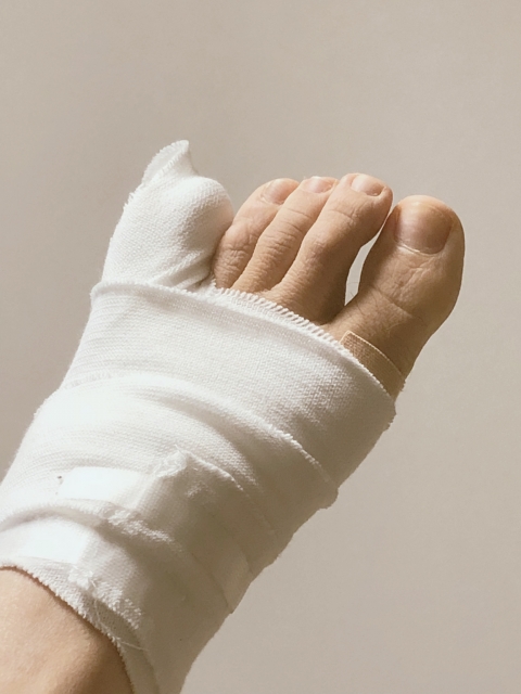 足の指の怪我