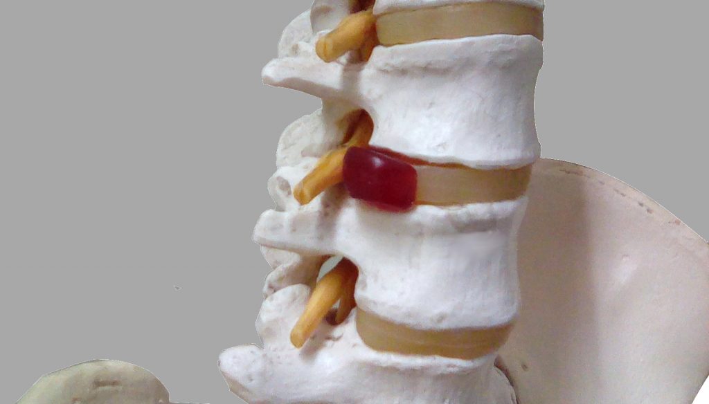 椎間板と坐骨神経